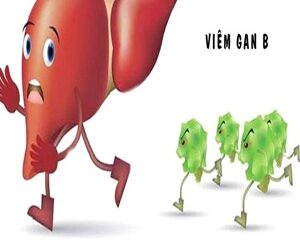 Hiểu Về Viêm Gan B Và Những Cách Phòng Ngừa Hiệu Quả