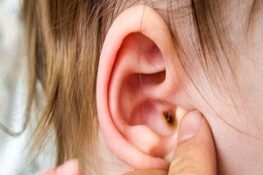 Cách Phòng Ngừa Viêm Tai Giữa Ở Trẻ Em