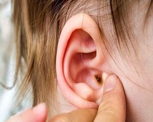 Cách Phòng Ngừa Viêm Tai Giữa Ở Trẻ Em