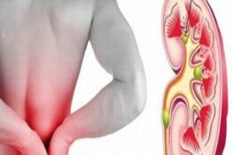 Tìm Hiểu Về Sỏi Thận: Nguyên Nhân, Các Triệu Chứng và Phương Pháp Điều Trị