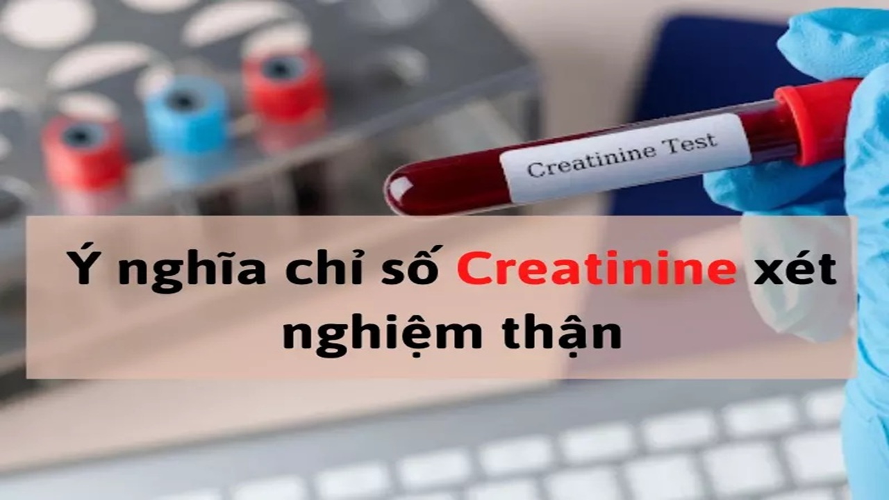 chỉ số creatinin