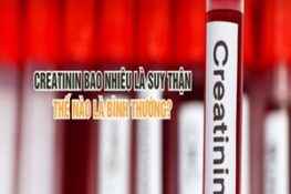 Creatinin Cao Hay Thấp – Làm Thế Nào Để Hiểu Rõ Về Chỉ Số Này?