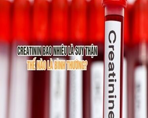 Creatinin Cao Hay Thấp – Làm Thế Nào Để Hiểu Rõ Về Chỉ Số Này?