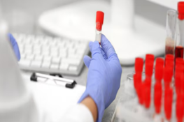 GGT là gì? Hiểu Biết Cần Thiết Về Chỉ Số Xét Nghiệm Máu