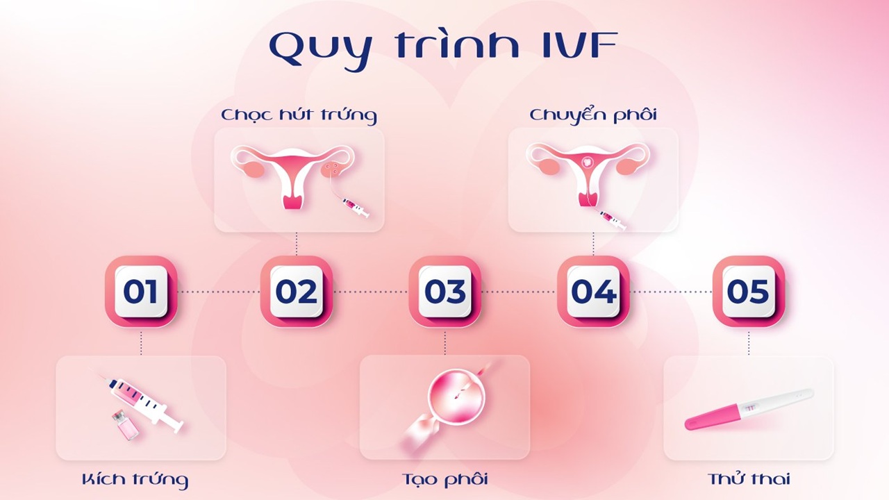 ivf là gì