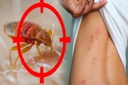 Rệp Giường Và Những Mối Nguy Hiểm Không Ngờ Đến