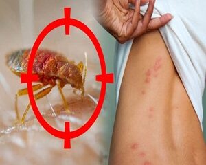 Rệp Giường Và Những Mối Nguy Hiểm Không Ngờ Đến