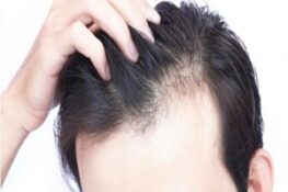 Rụng tóc không phải chuyện tuổi già – Cảnh báo sớm để kịp cứu mái tóc!