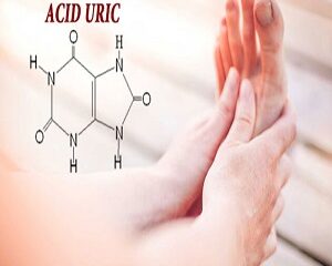 Acid Uric Cao Là Gì? Nguyên Nhân, Triệu Chứng Và Cách Điều Trị