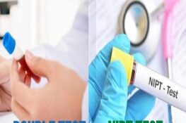 So Sánh NIPT và Double Test: Mẹ Bầu Nên Chọn Phương Pháp Nào?