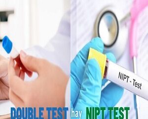 So Sánh NIPT và Double Test: Mẹ Bầu Nên Chọn Phương Pháp Nào?