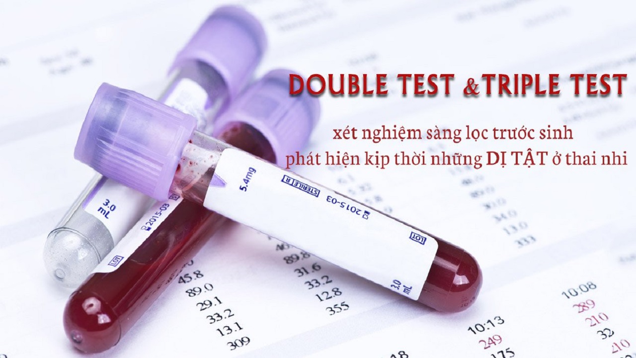 so sánh xét nghiệm nipt và double test
