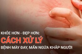 Ngứa khắp người: Nguyên nhân, dấu hiệu và cách xử lý hiệu quả