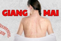 Bệnh giang mai: Nguyên nhân, triệu chứng và cách phòng tránh hiệu quả