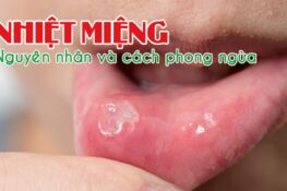 10 mẹo dân gian chữa nhiệt miệng an toàn, lành tính và dễ thực hiện