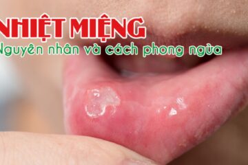 10 mẹo dân gian chữa nhiệt miệng an toàn, lành tính và dễ thực hiện