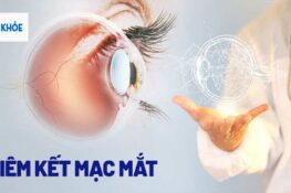 Nguyên nhân gây viêm kết mạc thường gặp và cách phòng ngừa an toàn