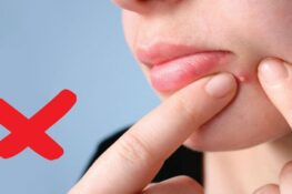 10 sai lầm thường gặp khi nặn mụn khiến da tổn thương nặng hơn